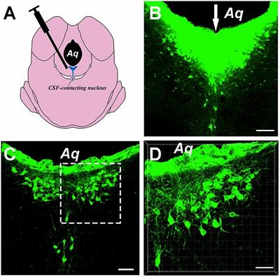 Monosynaptic Input Mapping of Diencephalic Projections to the Cerebrospinal Fluid-Contacting Nucleus in the Rat